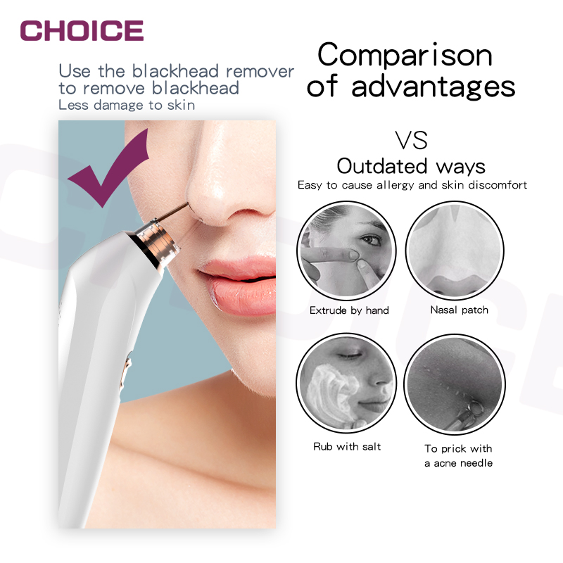 Blackhead remover - Image 2