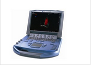 Hand-carried ultrasound MicroMaxx - Image 2