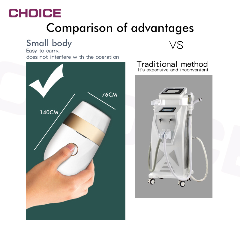 IPL hair removal - Image 2