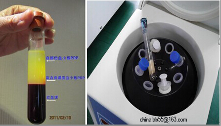 Low-Speed Tabletop Medical Centrifuge for PRP Preparation